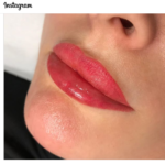blog photo which is based on lip-contouring